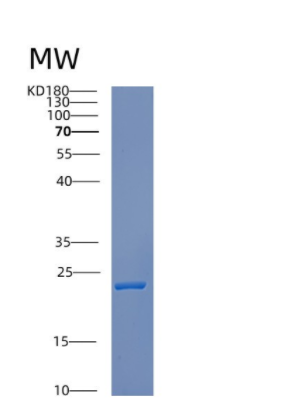 Recombinant Human CREG1 Protein