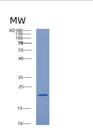 Recombinant Human CRYAB(Crystallin α B) Protein