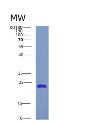 Recombinant Human CRYGC Protein