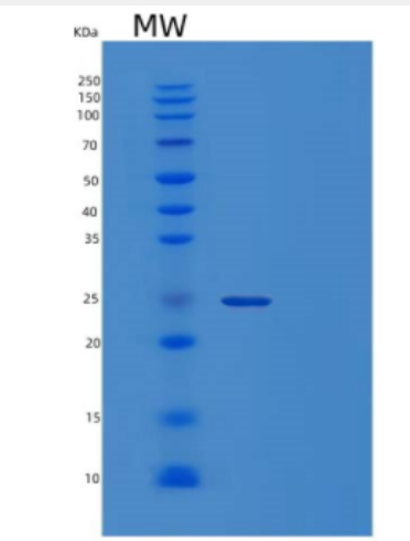 Recombinant Human CRYBA4 Protein
