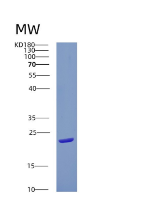 Recombinant Human CRYGN Protein