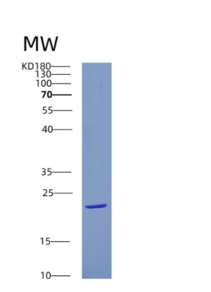Recombinant Human CRYGS Protein