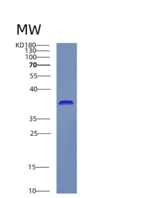 Recombinant Human CSF2RA Protein