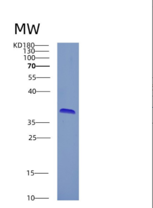 Recombinant Human CRYZ Protein