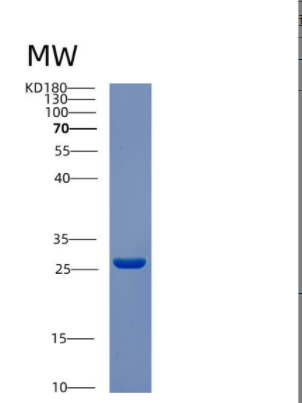 Recombinant Human CSN2 Protein