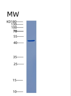 Recombinant Human CSNK2A2 Protein