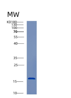 Recombinant Human CST1 Protein