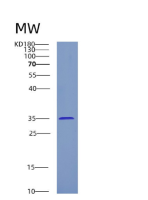 Recombinant Human CRYM Protein