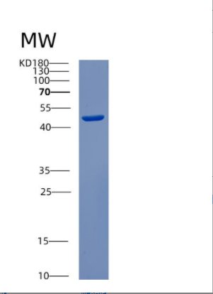 Recombinant Human CSNK2A1 Protein