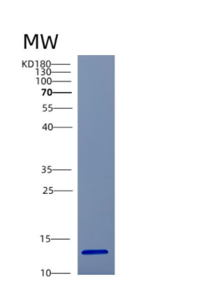 Recombinant Human CSTB Protein