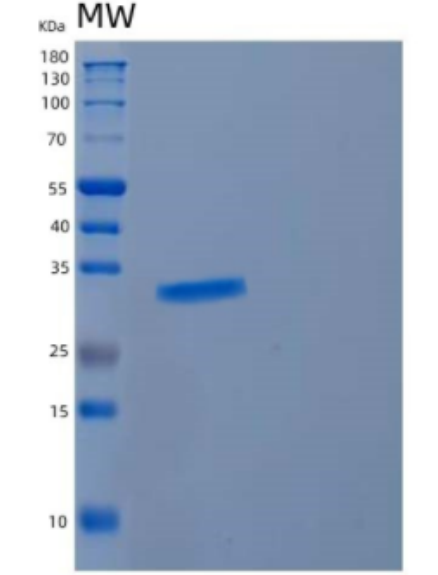 Recombinant Human CYB5R2 Protein