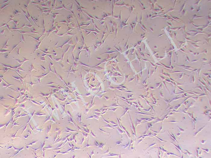 U-138MG人脑星形胶质母细胞瘤
