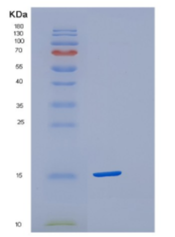 Recombinant Human Cystatin-S Protein