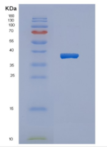 Recombinant Human CYTH2 Protein