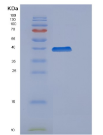 Recombinant Human Cyclin H Protein