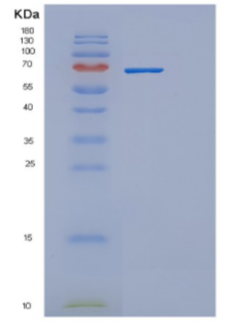 Recombinant Human DBH Protein