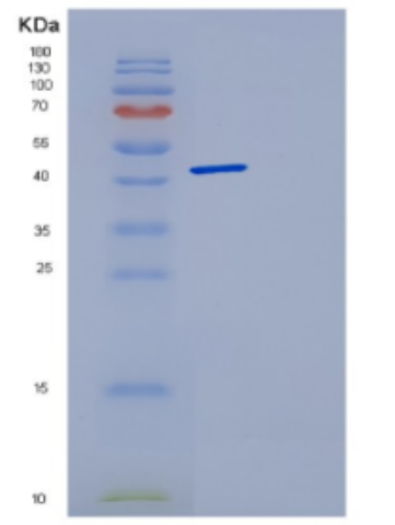 Recombinant Human DCTN2 Protein