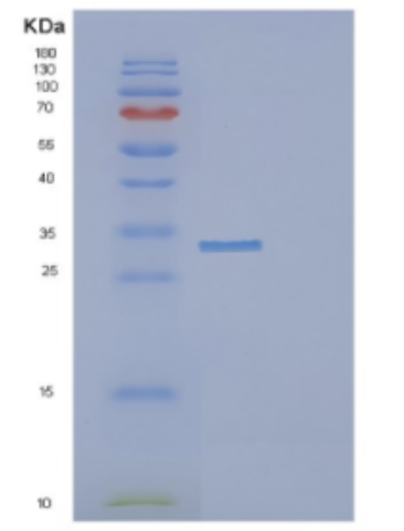 Recombinant Human DCUN1D1 Protein