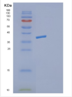 Recombinant Mouse Decorin Protein
