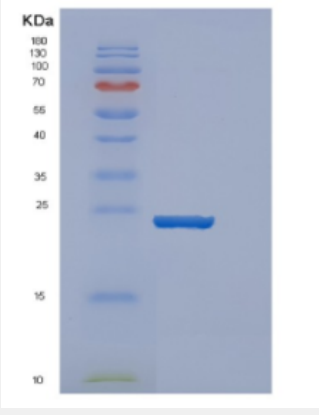 Recombinant Human DENR Protein