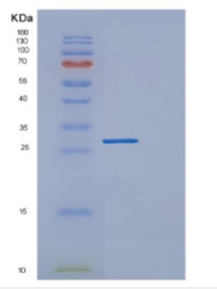 Recombinant Human DGCR6 Protein