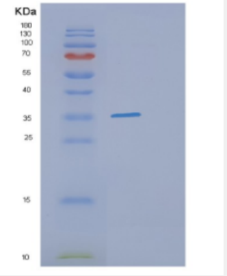 Recombinant Human DHRS9 Protein