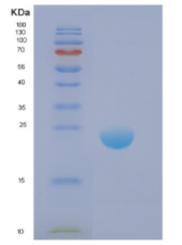 Recombinant Human DIRAS1 Protein