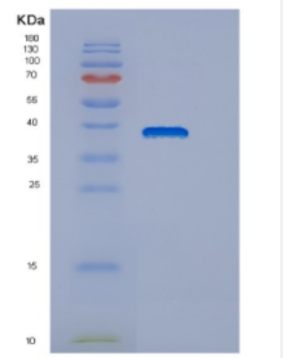 Recombinant Human DNAJB6 Protein