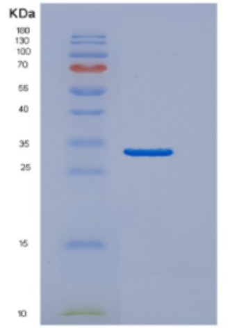 Recombinant Human DNAJB2 Protein