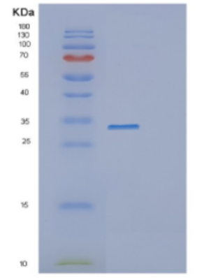 Recombinant Human DDX39A Protein
