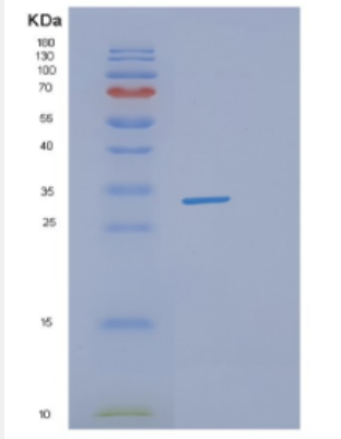 Recombinant Human DHRS4 Protein