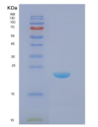 Recombinant E.coli Disulfide oxidoreductase (DsbA) E.coli Protein