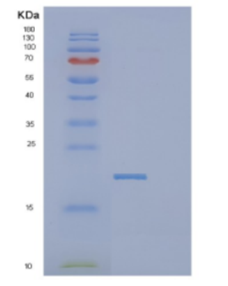 Recombinant Human DCTPP1 Protein