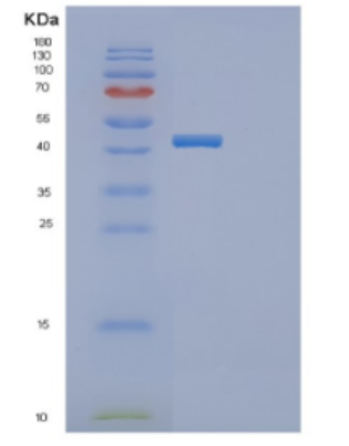 Recombinant Human DDR2 Protein