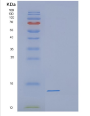 Recombinant Human DEFB118 Protein