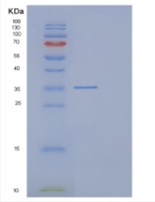 Recombinant Human DCUN1D4 Protein