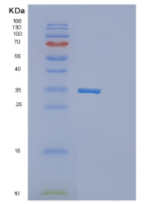 Recombinant Human DECR1 Protein