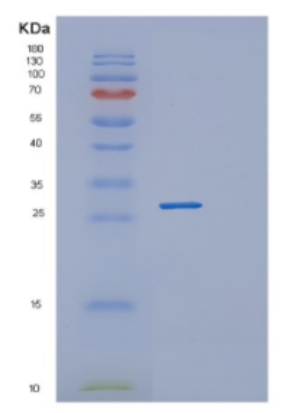 Recombinant Human DGCR6L Protein
