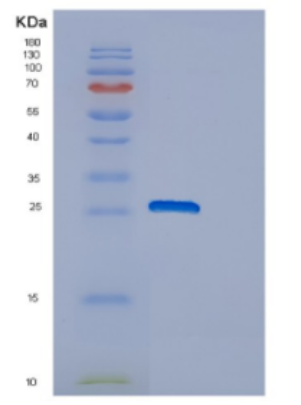 Recombinant Human DNAJC12 Protein