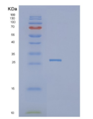 Recombinant Human DDIT4 Protein
