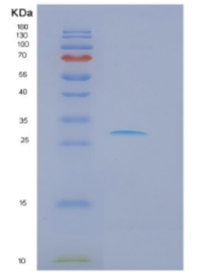 Recombinant Human DKK1 Protein