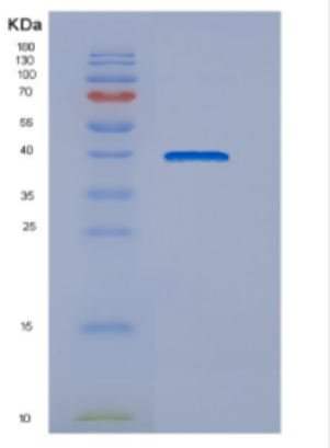 Recombinant Human DNAJB4 Protein