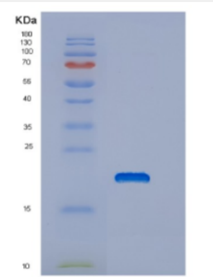Recombinant Human DNAJC24 Protein