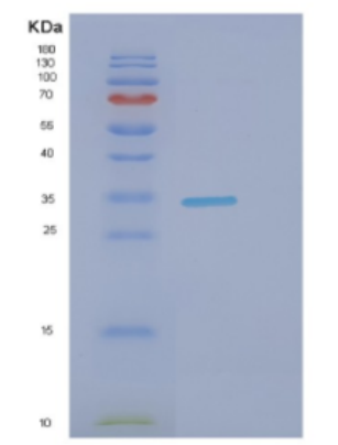 Recombinant Human DNALI1 Protein