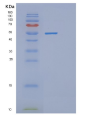 Recombinant Human DDX56 Protein