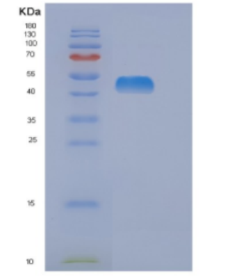 Recombinant Human DLD Protein