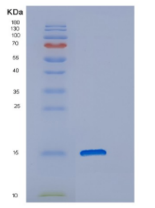 Recombinant Human DNAJC19 Protein