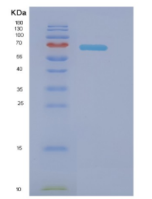 Recombinant E.coli Dnak (full length; 1-638) Protein