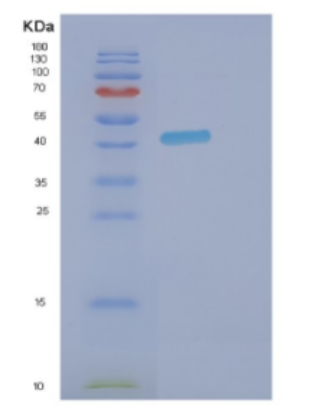 Recombinant Human DNMT3L Protein