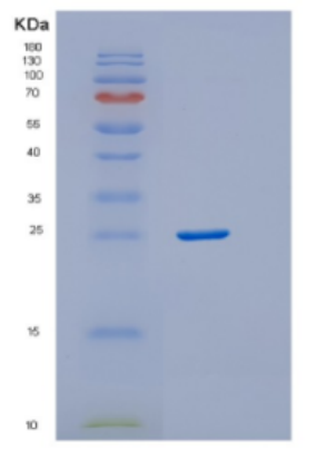 Recombinant Human DTD1 Protein